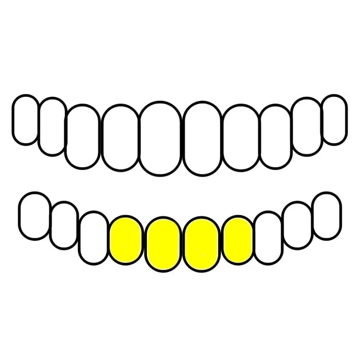 Bling Cartel Admin Rings Gold Plated over 925 Silver TwoTone Diamond Dust Starburst Custom Grillz