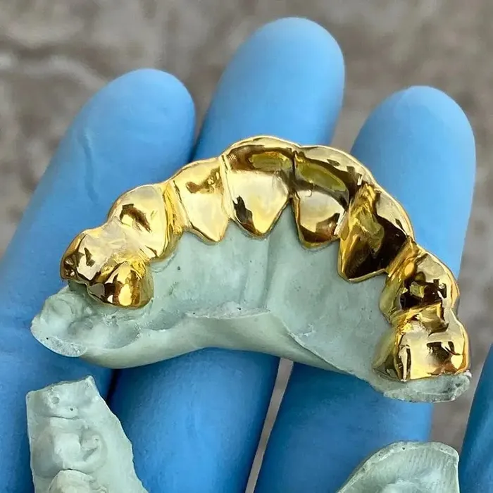Bling Cartel Admin Rings Gold Plated over 925 Silver TwoTone Diamond Dust Starburst Custom Grillz
