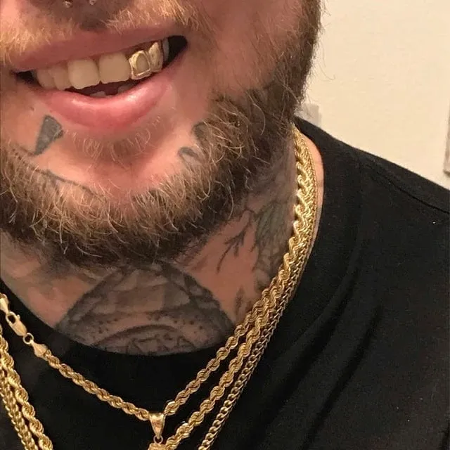 Bling Cartel Admin Rings Real Solid 10K Gold Double OpenSolid Caps Custom Grillz