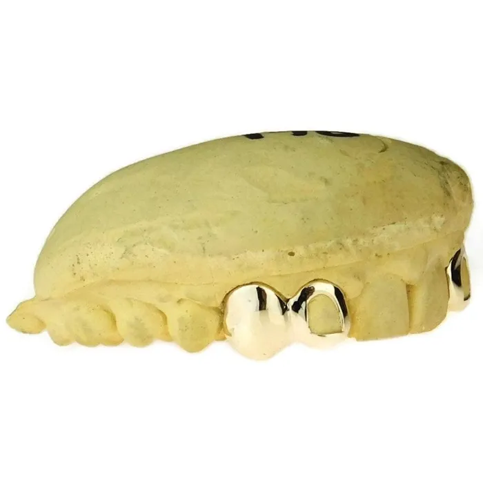 Bling Cartel Admin Rings Real Solid 10K Gold Double OpenSolid Caps Custom Grillz