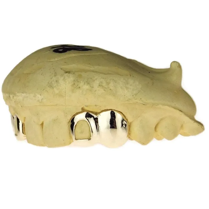 Bling Cartel Admin Rings Real Solid 10K Gold Double OpenSolid Caps Custom Grillz