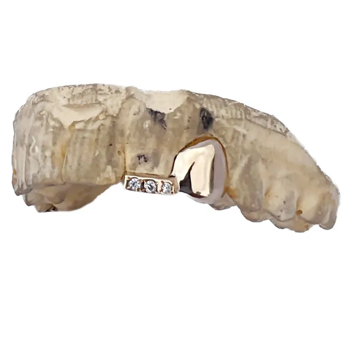 Bling Cartel PreStyled Sets 10K Gold Grillz Double Canine Incisor Iced Inlay Side Bar CZ Teeth Grills Bling Cartel PreStyled Sets 10K Gold Grillz Double Canine Incisor Iced Inlay Side Bar CZ Teeth Grills
