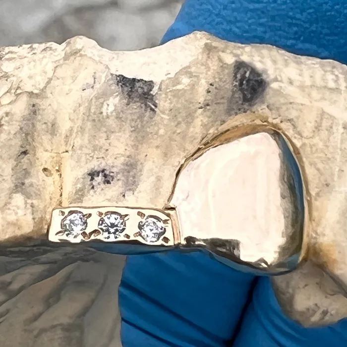 Bling Cartel PreStyled Sets 10K Gold Grillz Double Canine Incisor Iced Inlay Side Bar CZ Teeth Grills