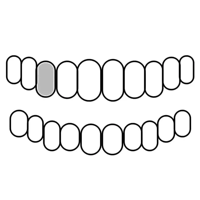 Rings Bling Cartel Admin 925 Sterling Silver CZ Single Cap Iced Bling Out Custom Tooth