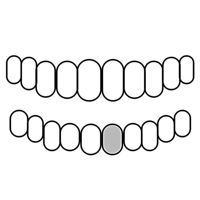 Rings Bling Cartel Admin 925 Sterling Silver CZ Single Cap Iced Bling Out Custom Tooth