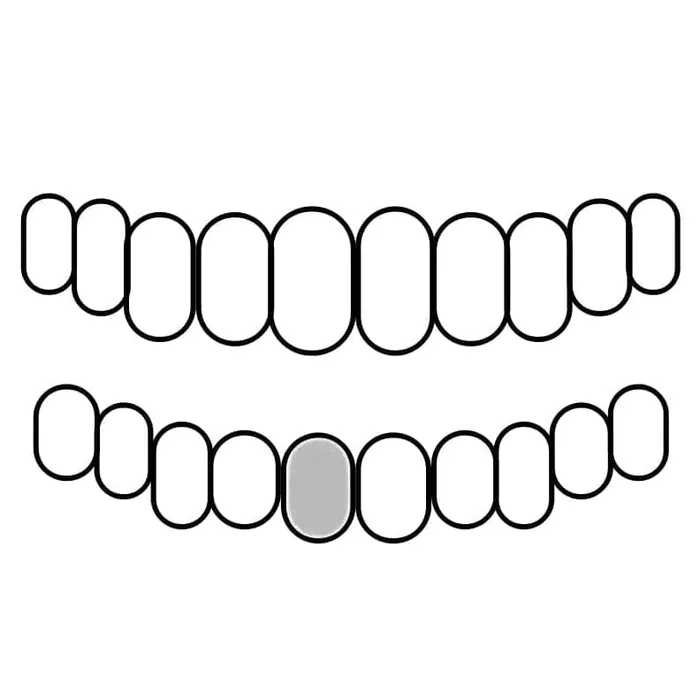 Rings Bling Cartel Admin 925 Sterling Silver CZ Single Cap Iced Bling Out Custom Tooth