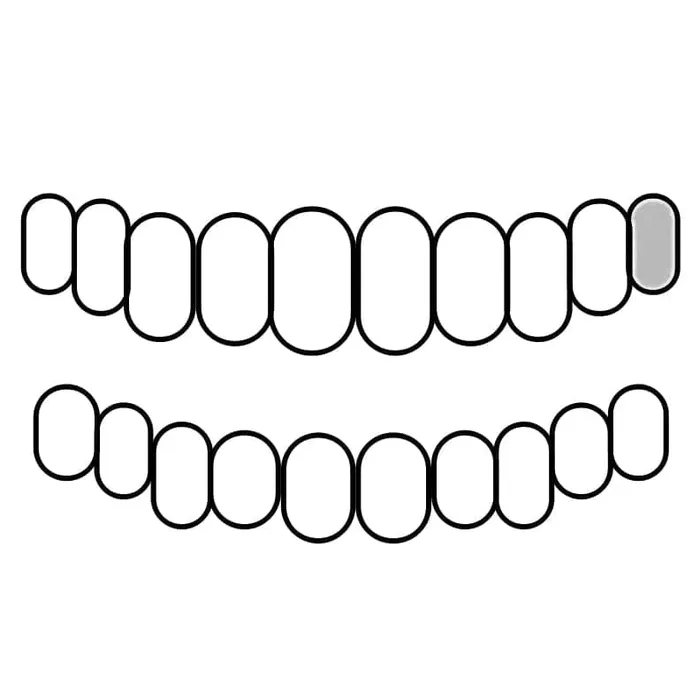 Rings Bling Cartel Admin 925 Sterling Silver CZ Single Cap Iced Bling Out Custom Tooth