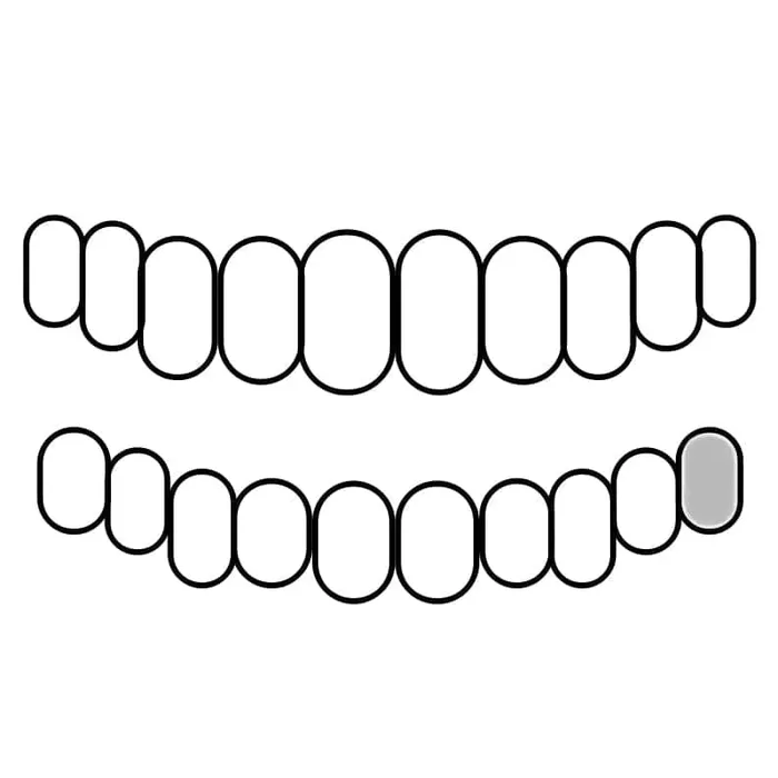 Rings Bling Cartel Admin 925 Sterling Silver CZ Single Cap Iced Bling Out Custom Tooth