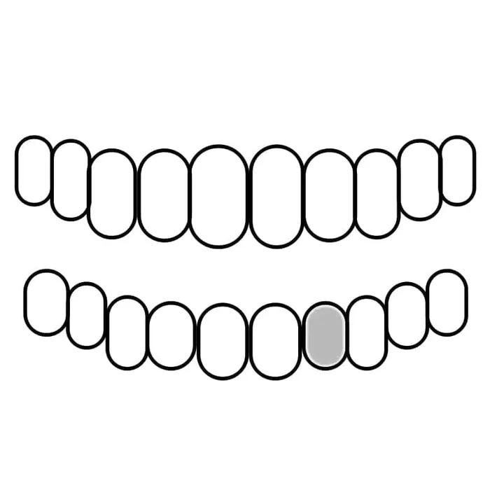 Rings Bling Cartel Admin 925 Sterling Silver CZ Single Cap Iced Bling Out Custom Tooth