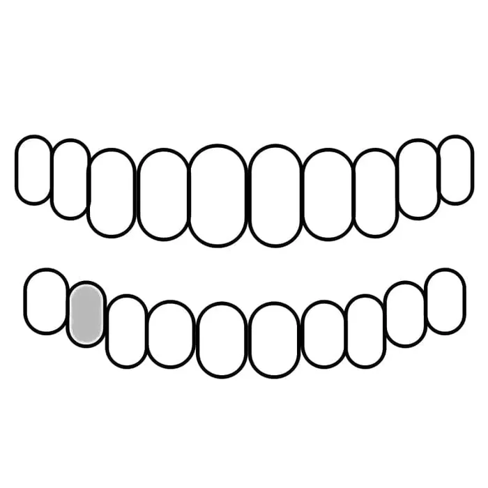 Rings Bling Cartel Admin 925 Sterling Silver CZ Single Cap Iced Bling Out Custom Tooth
