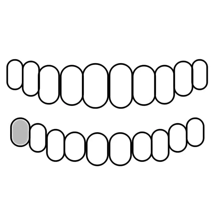 Rings Bling Cartel Admin 925 Sterling Silver CZ Single Cap Iced Bling Out Custom Tooth