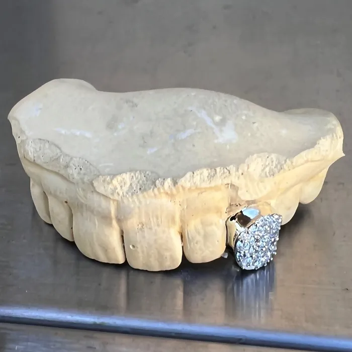Rings Bling Cartel Admin 925 Sterling Silver CZ Single Cap Iced Bling Out Custom Tooth