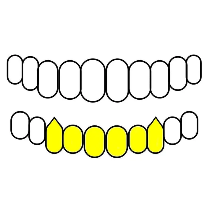 Rings Real 14K Gold FourOpen Face Vampire Fang Custom Grillz Bling Cartel Admin