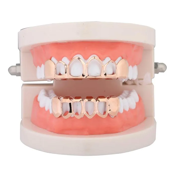Dropshipped via Social Commerce Network PreStyled Sets Loom Tree 18K Grills 6 Fang Top Bottom Teeth Grill Set Halloween Cosplay Rose Gold Dropshipped via Social Commerce Network PreStyled Sets Loom Tree 18K Grills 6 Fang Top Bottom Teeth Grill Set Halloween Cosplay Rose Gold